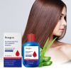 Scalp Refreshing Anti-Dandruff Shampoo, Oil Control Balancing Hair Cleansing Shampoo with Aloe Extract